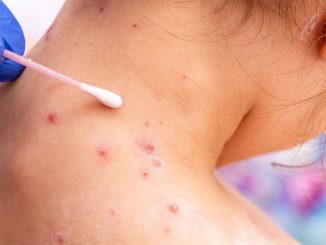 ВОЗ понравилось править миром: постоянно появляются новые болячки...