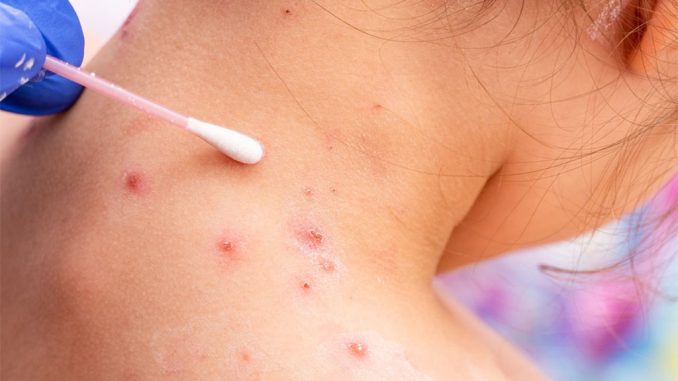 ВОЗ понравилось править миром: постоянно появляются новые болячки... ВОЗ понравилось править миром: постоянно появляются новые болячки...